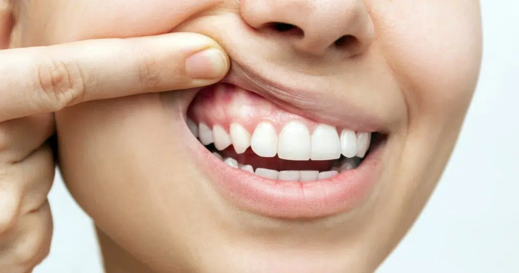 Essential Gum Care 1